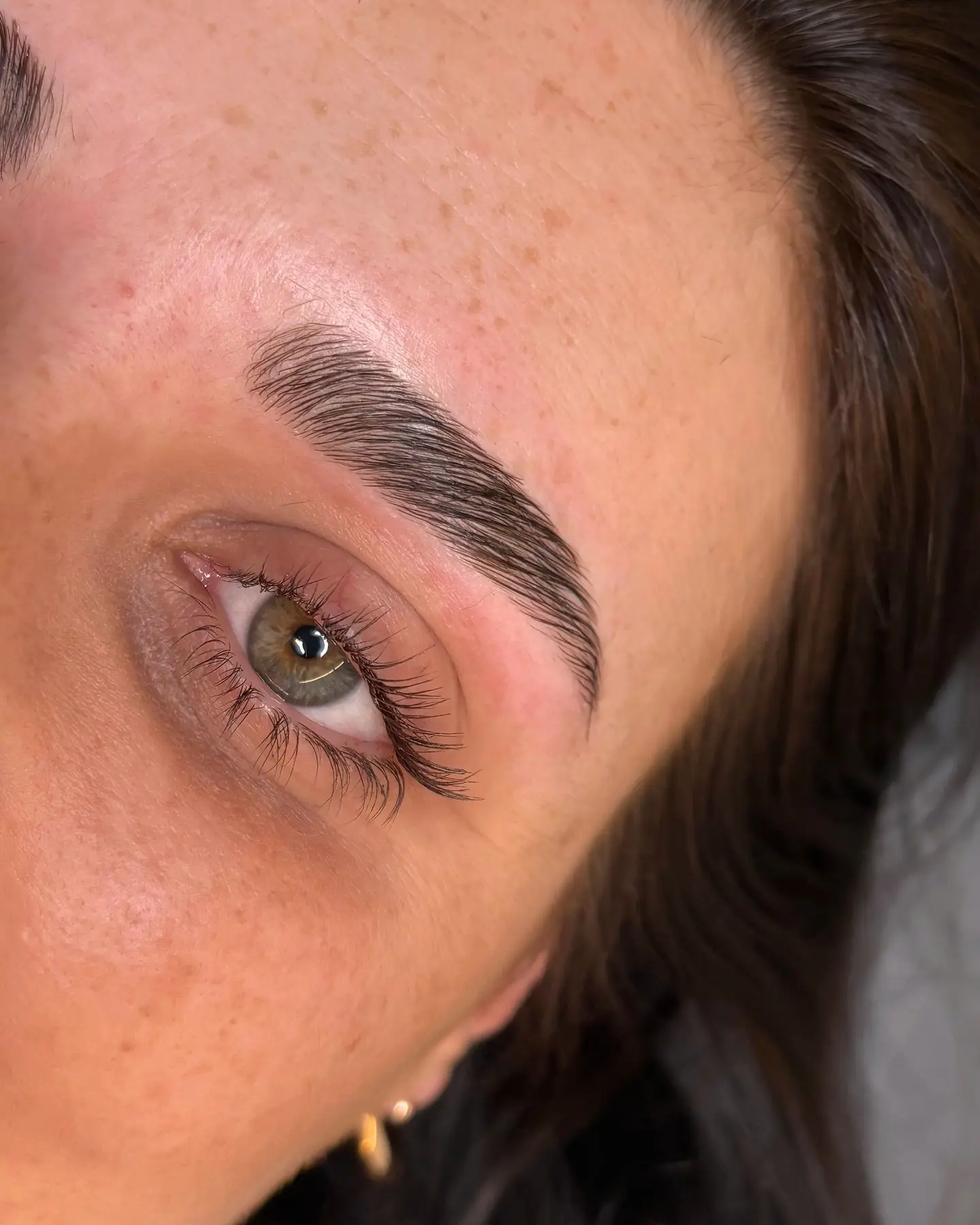 Sourcil après un browlift, poils disciplinés vers le haut